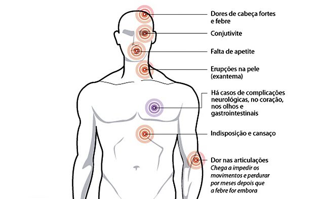 Febre Chikungunya - Laboratório São Paulo