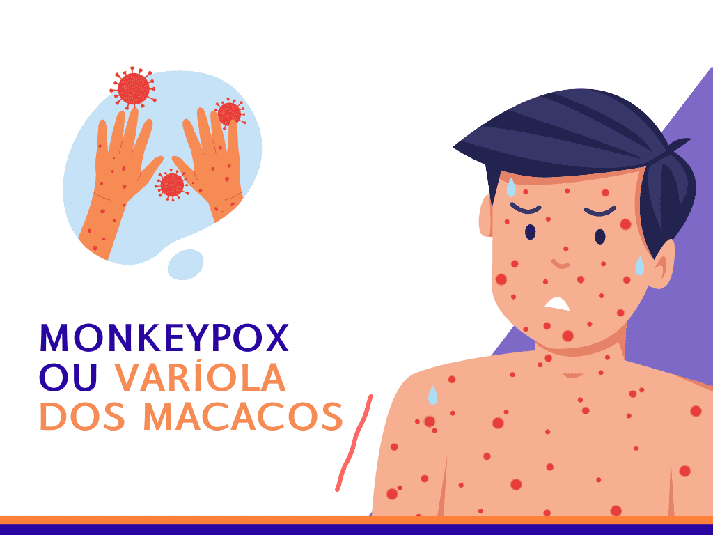 Monkeypox ou Varíola dos Macacos - Laboratório São Paulo