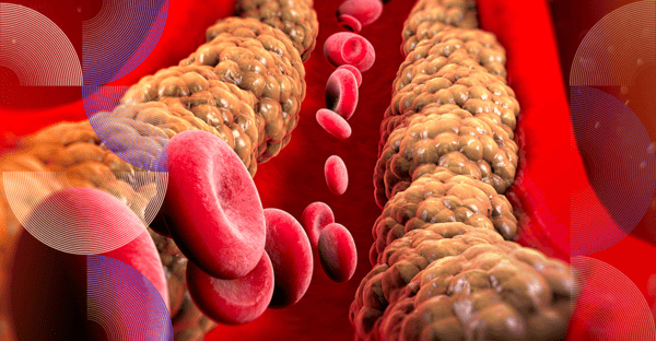 Lipoproteína (A) - Laboratório São Paulo