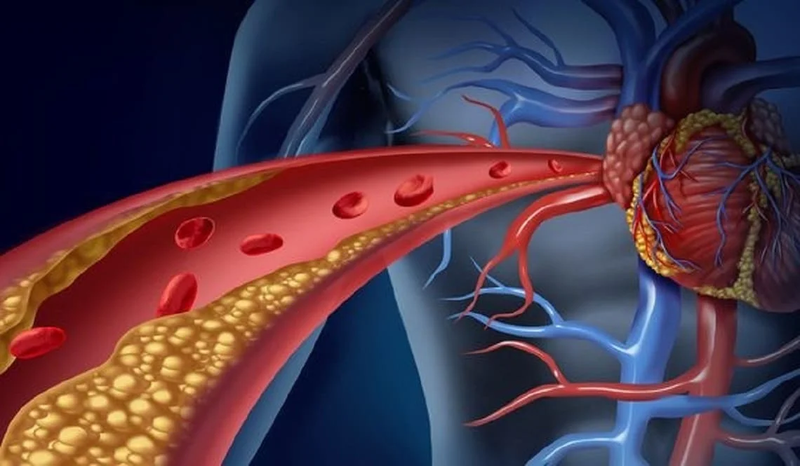 Diretriz Brasileira de Dislipidemias e Prevenção da Aterosclerose – 2025 - Laboratório São Paulo